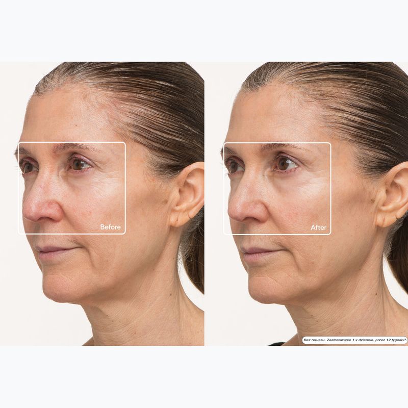 Kaukė LED veidui Therabody TheraFace LED Mask 10