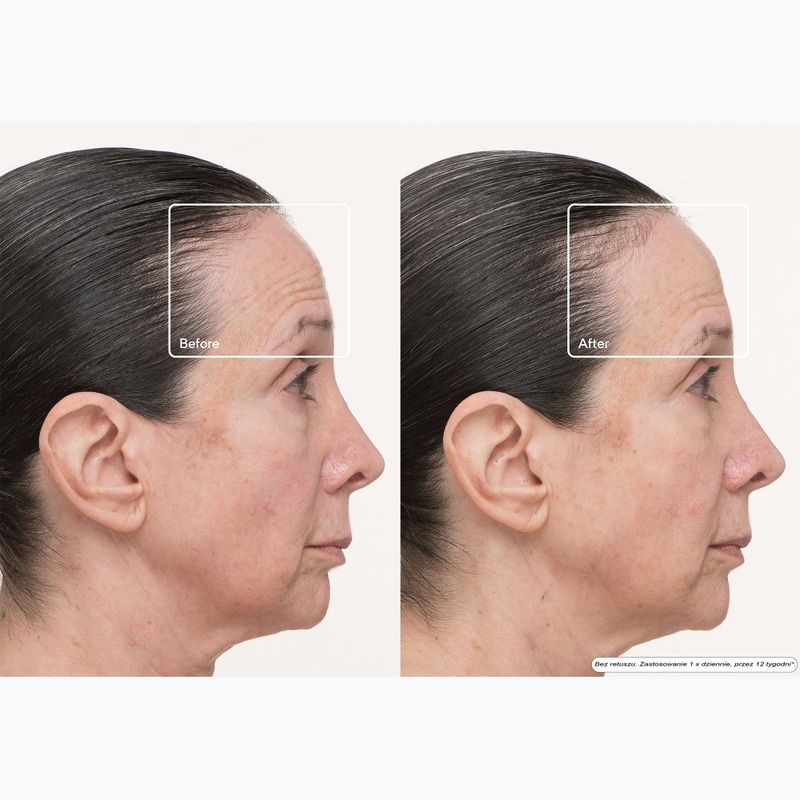 Kaukė LED veidui Therabody TheraFace LED Mask 11