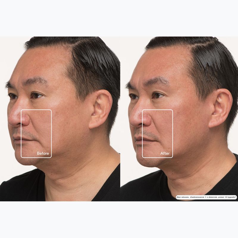 Kaukė LED veidui Therabody TheraFace LED Mask 12