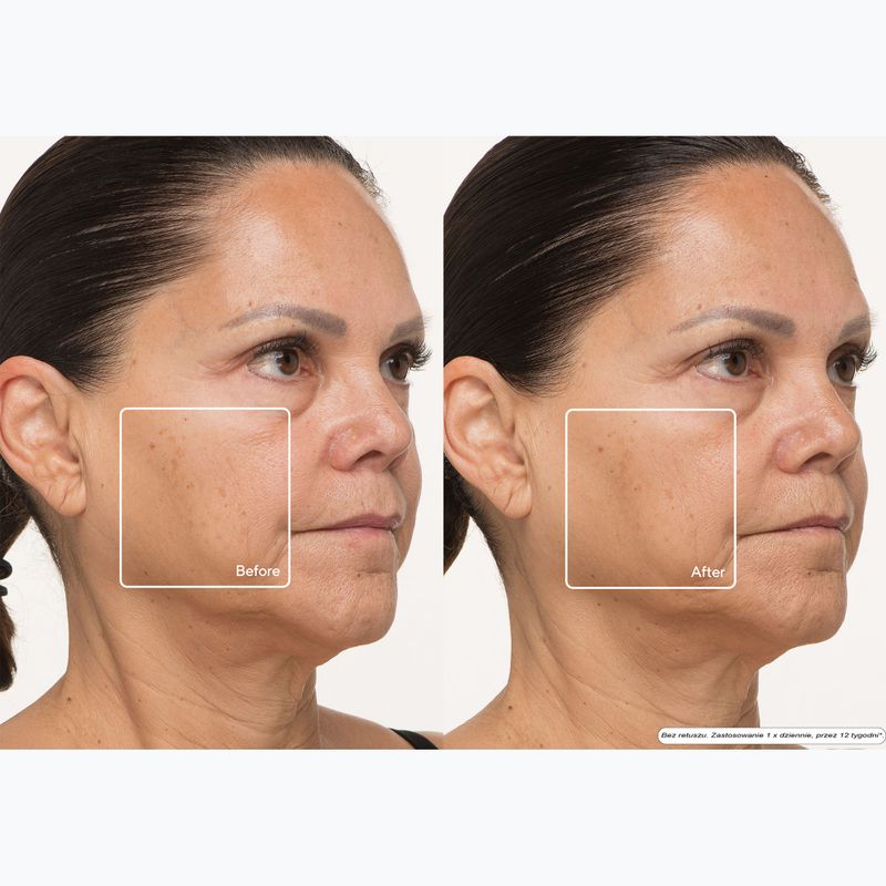 Kaukė LED veidui Therabody TheraFace LED Mask 13